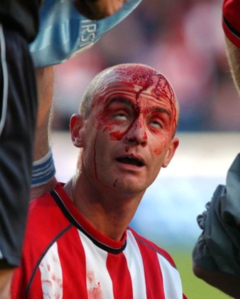 Southampton versus Manchester City 01.11.03
Saints Chris Marsden bleeding from the head and eyes rolling, after he collides with Man Citys Jihai Sun.
