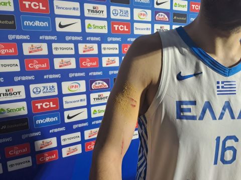 Mundobasket 2023, Παπανικολάου: Οι πληγές στο δεξί του χέρι και το αιμοστατικό spray που του χορηγήθηκε